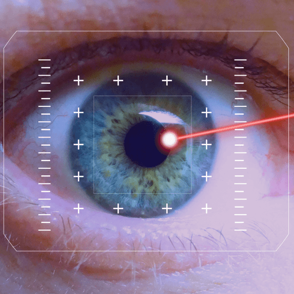 Fotocoagulação a laser